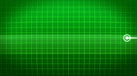 EKG Stock Footage 10915308