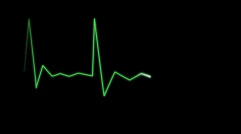 EKG 스톡 동영상 32351339