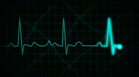 Ekg green on black background Video stock 4142108