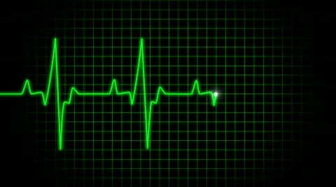 Ekg green Video stock 556036