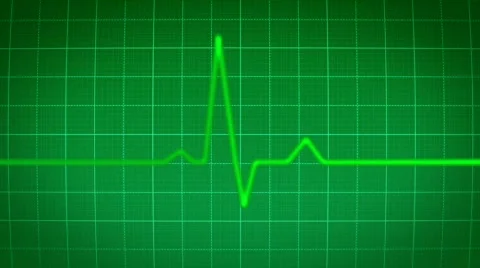 Ekg heart monitor with sound Stock Footage