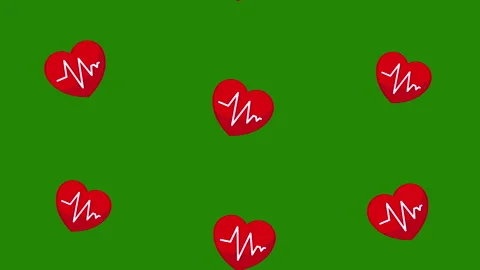 EKG heart pattern background animation.4K motion animation. Stock Footage 166673502