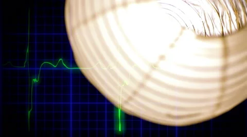 EKG heartbeat death lamp bouncing Stock Footage