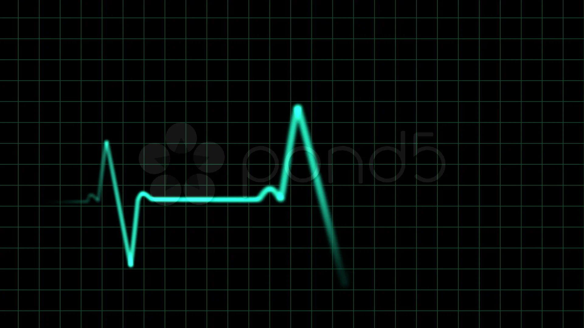 EKG heartbeat monitor, animation | Stock Video | Pond5