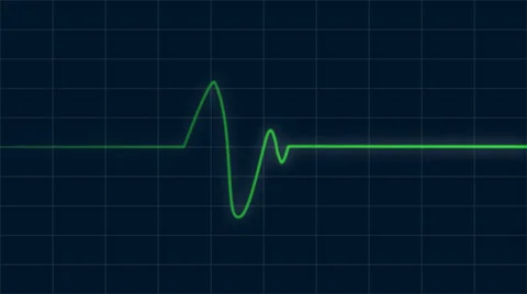 EKG, Heartbeat monitor visual effect, cgi loop Stock Footage