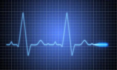 Ekg Stock Illustration