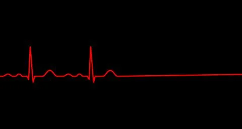 Ekg line. Heart stops beating. Death. Stock Illustration
