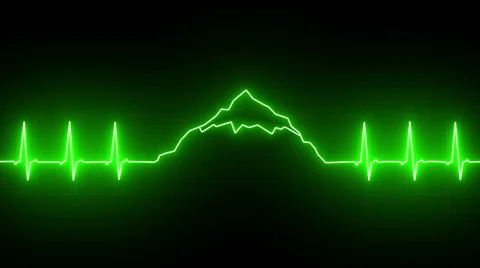 EKG line mountain Stock Footage 68026323
