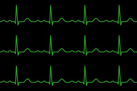 Ekg lines. Heartbeat. Seamless pattern. Stock Illustration