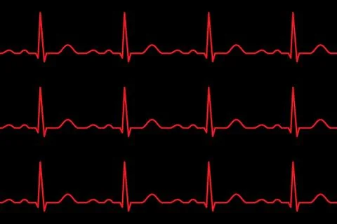 Ekg lines. Heartbeat. Seamless pattern. Stock Illustration