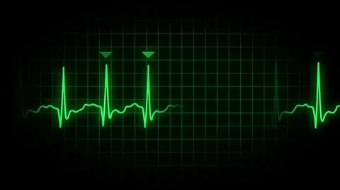 EKG Loop 2409 Stock Footage 10792672