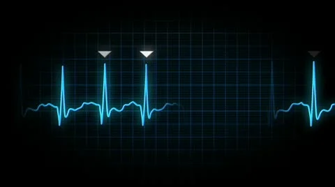EKG Loop 2410 Stock Footage 10792682
