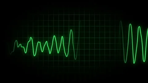 EKG Loop 2411 Stock Footage 10792946