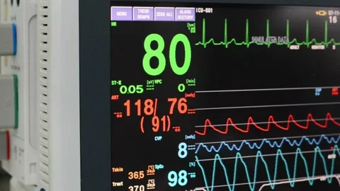 Ekg Monitor in Icu Unit Ecg In Intensive... | Stock Video | Pond5