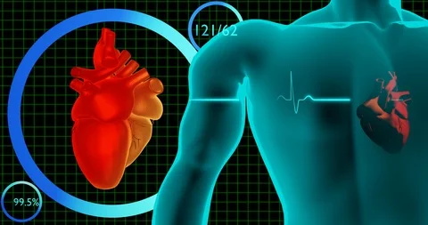 EKG Normal Heart Attack Congestive Heart Failure cardiovascular disease concept Stock Footage 100648776