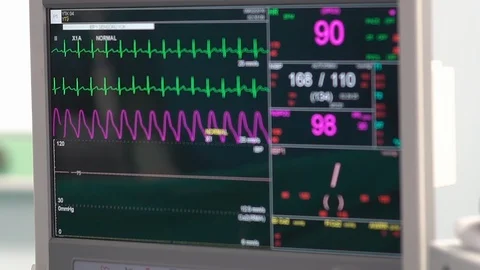 Ekg in Operation Room Stock Footage 121151312