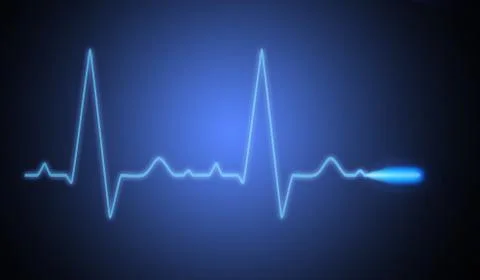 Ekg Stock Photos