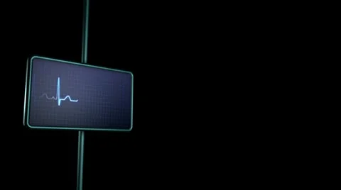 EKG. Pulse waveform. Looping. With Alpha Stock Footage 26200823