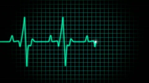 Ekg turkish Stock Footage 556860
