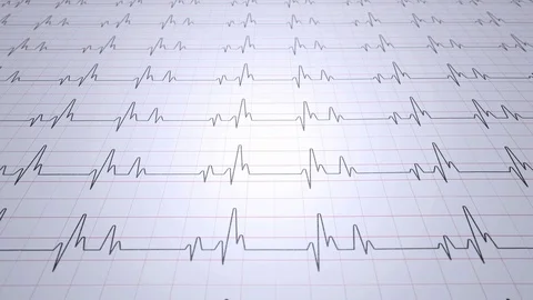 EKG1 Stock Footage 128881457