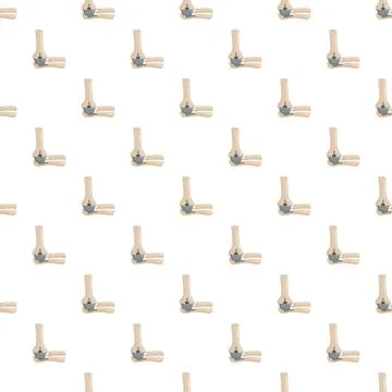 Elbow joint replacement surgery implant medical pattern Stock Illustration