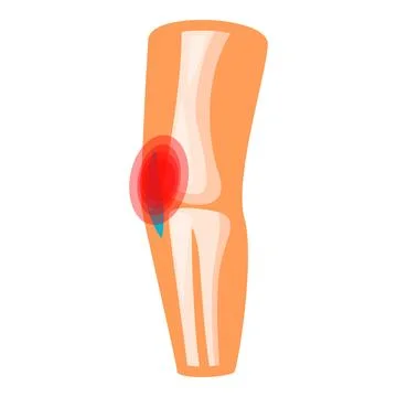 Elbow joint showing bones and ligaments suffering from pain Stock Illustration