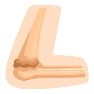 Elbow joint showing bones and cartilage in bending position 库存插图