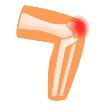 Elbow joint showing bones and ligaments experiencing pain Illustrazione stock
