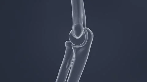 Elbow joint X-ray of 3D illustration Stock-Illustration