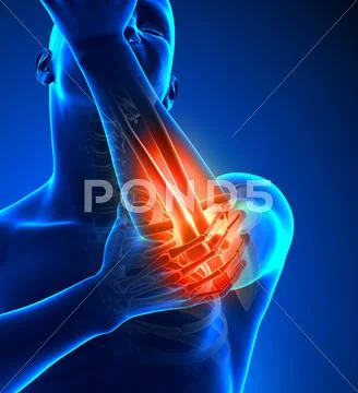 Elbow Pain Male - Front view Stock Photos