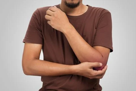 Elbow pain Foto stock