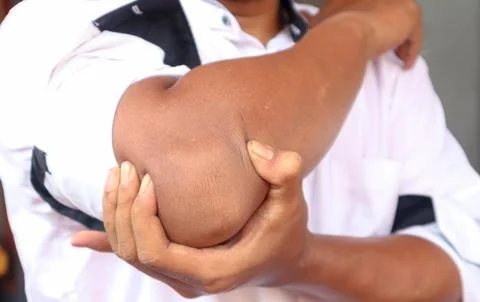 Elbow pain Stock Photos