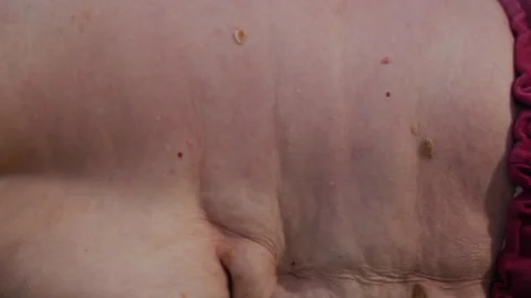 Elderly Client Resting After Massage Stock-Footage 311309459