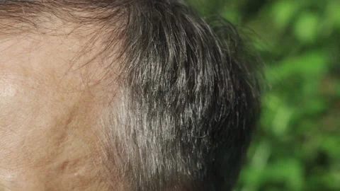 An Elderly man runs his hand through his gray hair Stockbeeldmateriaal 161336210