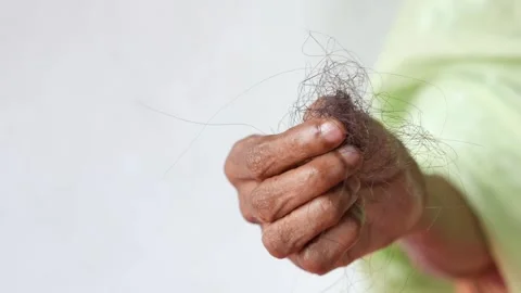 Elderly woman holding bundle of fallen hair representing medical issue and .. Stock Footage 332471461