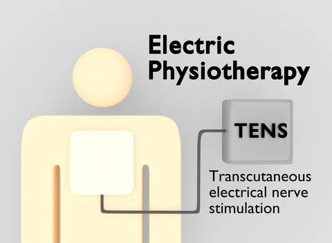 Electric Physiotherapy concept イラスト素材