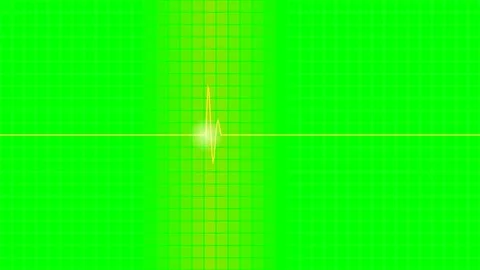 Electric Pulse Waveform Animated Motion Graphic Concept Stock Footage 341838778