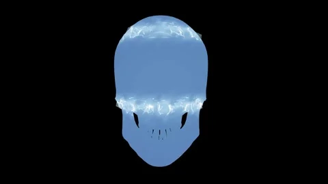 Electric Skull Stock Footage 248735279