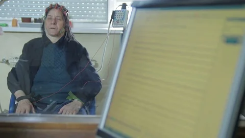 Electrical activity of patient brain on screen,graphic view of waves,EEG method Stock Footage 75818406