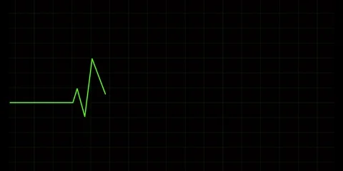 Electro cardiogram 4k Stock-Footage 123686110