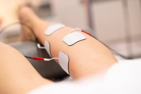 Electro stimulation in physical therapy to a young woman Foto stock