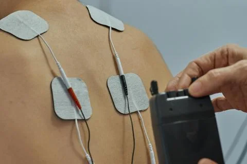 Electro stimulation in physical therapy to a young woman. Medical check at th Stock Photos