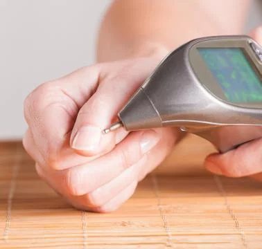 Electroacupuncture finding a point Stock Photos