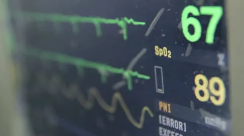 Electrocardio 4 Stock-Footage 10608008