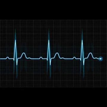 Electrocardiogram 2d illustration on black background Stock Illustration