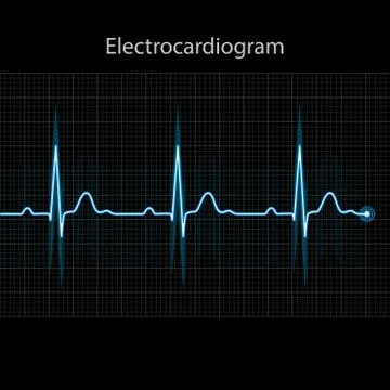 Electrocardiogram 2d illustration Stock Illustration
