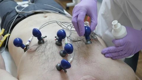 Electrocardiogram analysis of Heart Stock Footage 99885638