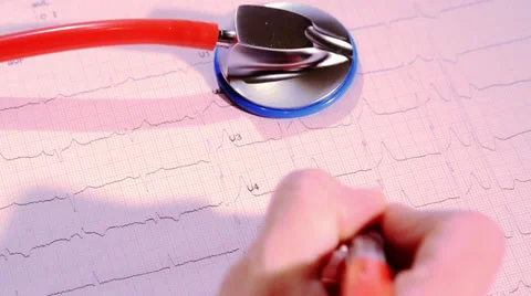 Electrocardiogram and doctor Video stock 32454769