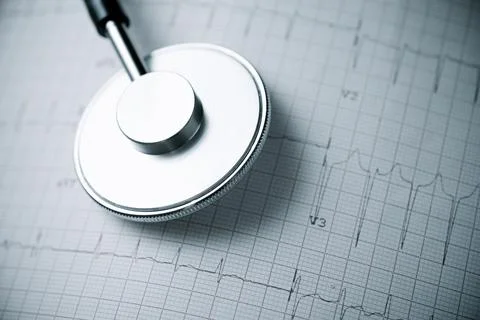 Electrocardiogram and stethoscope Stock Photos