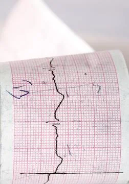 Electrocardiogram ctg Stock Photos